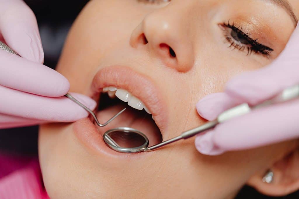 A woman's teeth being examined by a dentist and applying sealants.