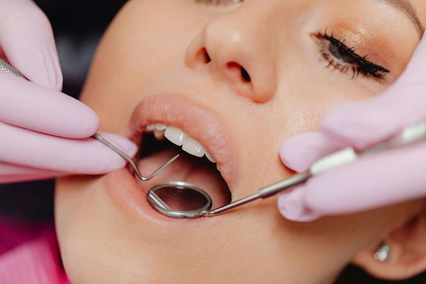 A woman's teeth being examined by a dentist and applying sealants.