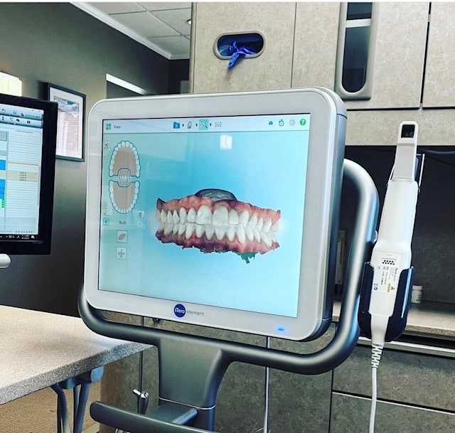 Invisalign dental solution featured in a dentist's office with a computer and a monitor.